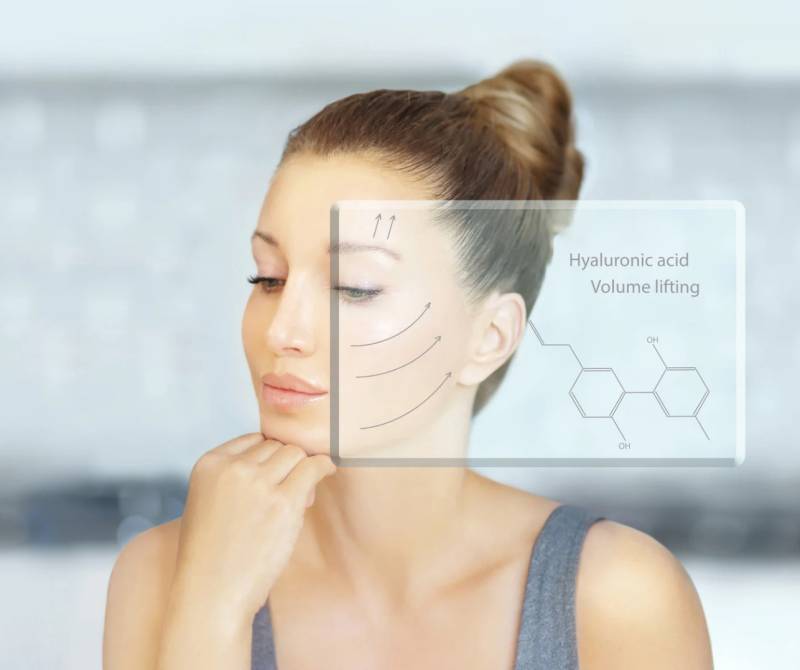 L’acide hyaluronique dans la prise en charge du vieillissement en cabinet de médecine esthétique