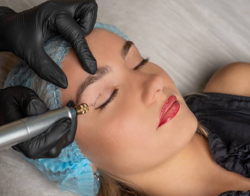 Blépharoplastie par plex’r ou plasma pen au centre Athéna Aesthé
