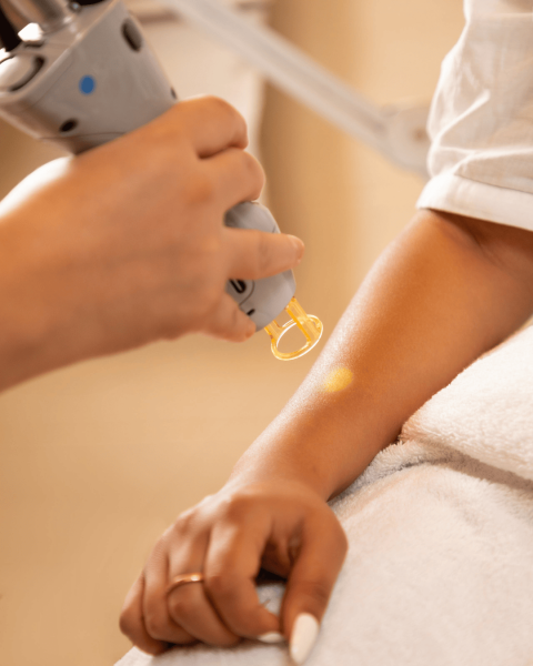 Peut-on faire de l’épilation laser en été ? Oui, mais pas n’importe comment !
