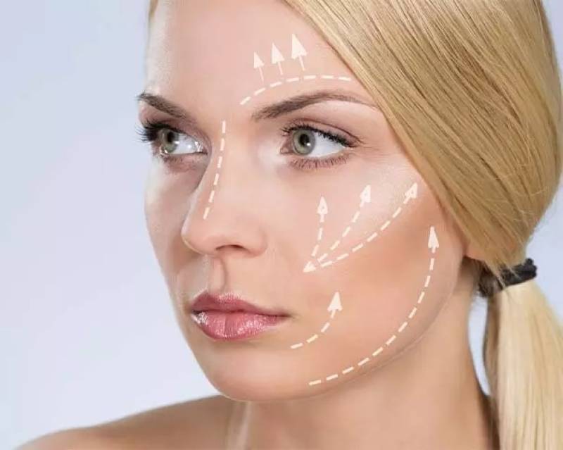 Les fils tenseurs pour le traitement esthétique du visage en région PACA
