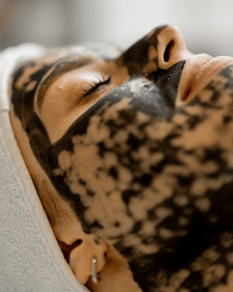 Carbon Peel : pourquoi tout le monde en parle ?