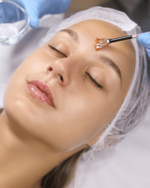 Peeling à Cuers : à quoi s’attendre chez Athena Aesthé ?