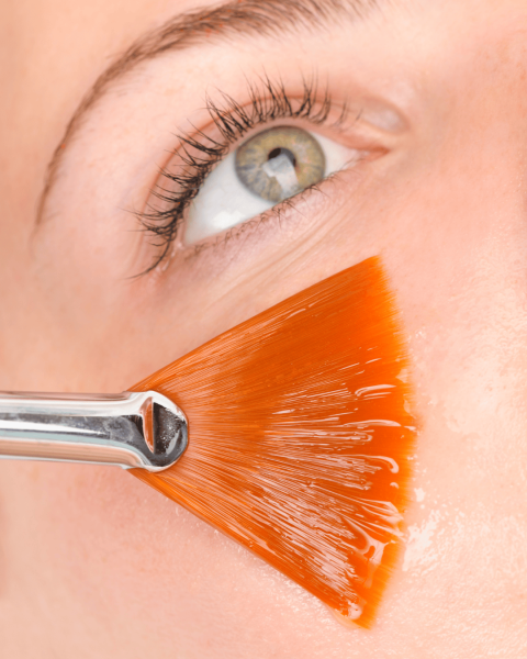 Peeling visage : quel type de peeling choisir pour votre peau chez Athena AESTHE à Cuers proche de Puget-Ville ?