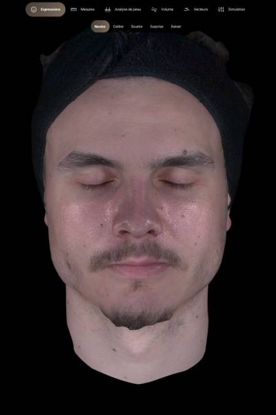 Système Aura 3D : analyse et suivi précis du visage chez Athena AESTHÉ à Cuers, près de La Valette-du-Var et Toulon